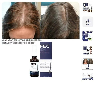 FEG Plus Hair Growth Stimulator Spray – Natural Formula with Anagain, Rosemary & Camellia (50ml)