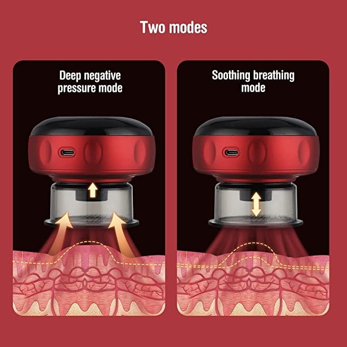 Smart Electric Cupping Therapy Massager with Red Light & Heat – Rechargeable Body Relaxation Device