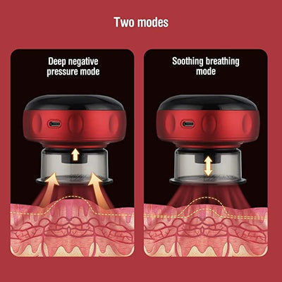 Smart Electric Cupping Therapy Massager with Red Light & Heat – Rechargeable Body Relaxation Device