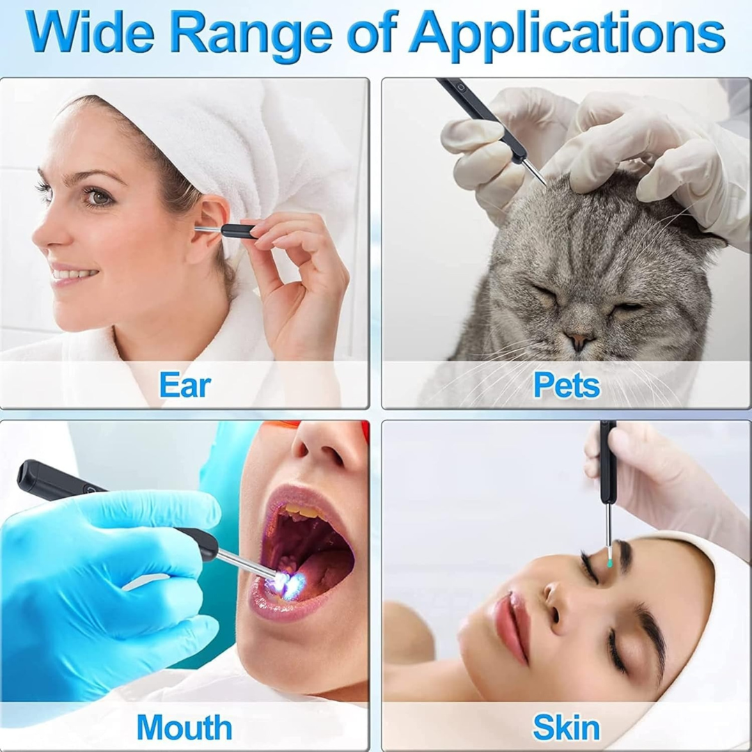 Smart WiFi Visual Ear Cleaner with HD Camera – Safe, Waterproof & Comfortable for Kids and Adults